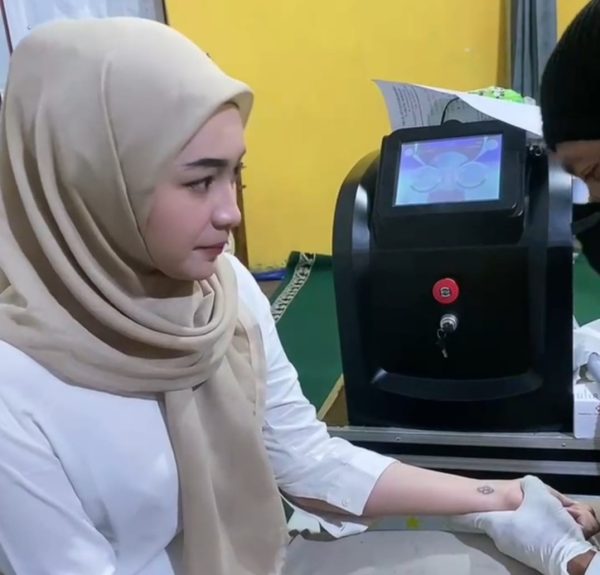 Layanan Penghapusan Tato Gratis Mualaf Center Semarang - Gambar 3